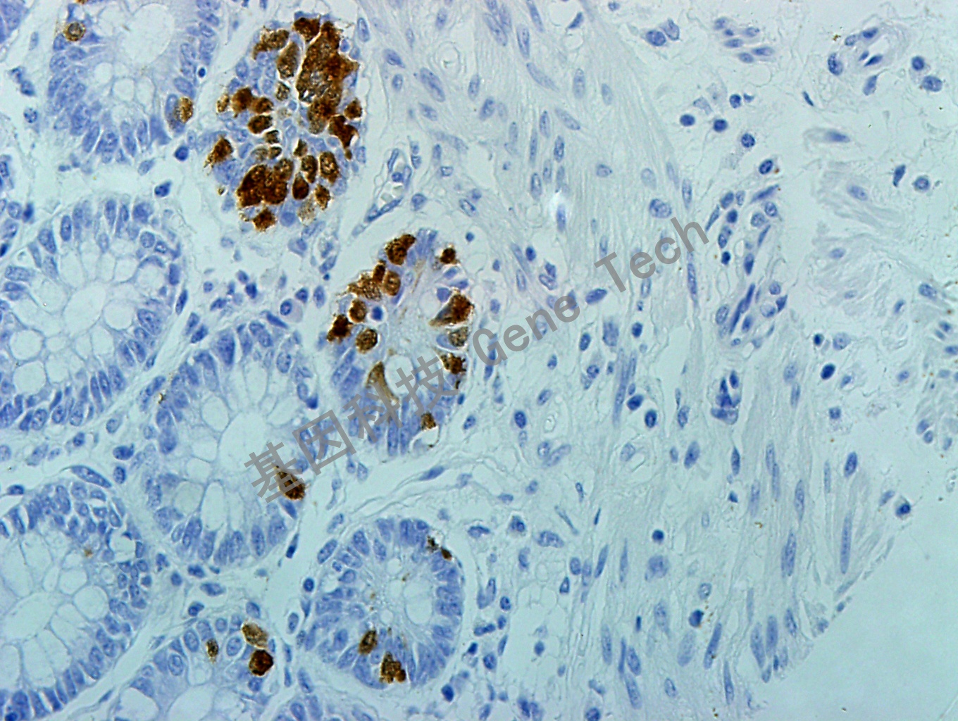 1646360038170688.jpg 1646360038170688.jpg